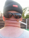 HWPE1i8.png