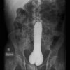 large-dildo-butt-x-ray-elite-daily-1.jpg