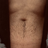 MarcusMarcus