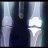 MrXray